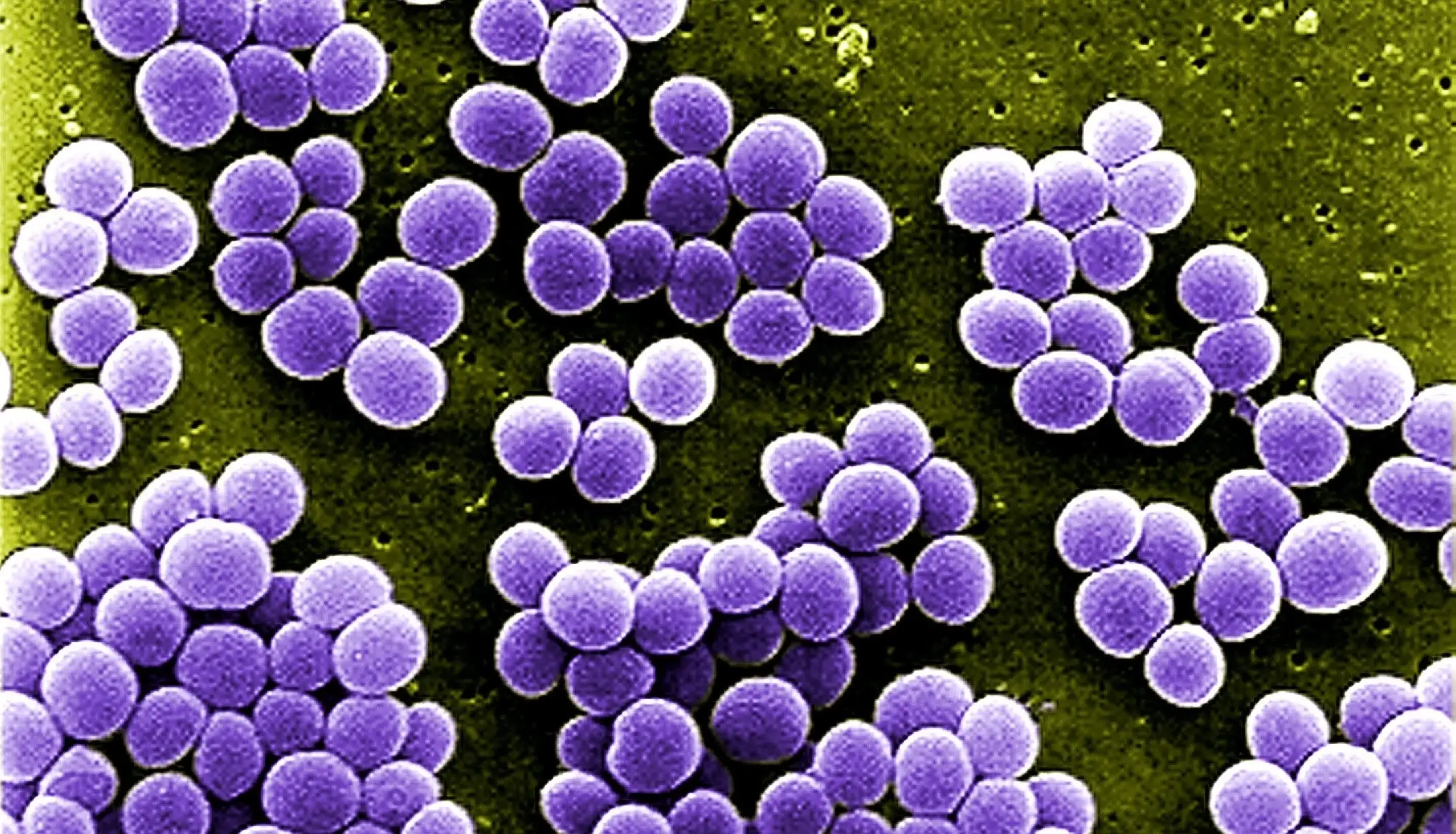 Staphylococcus aureus bacteria